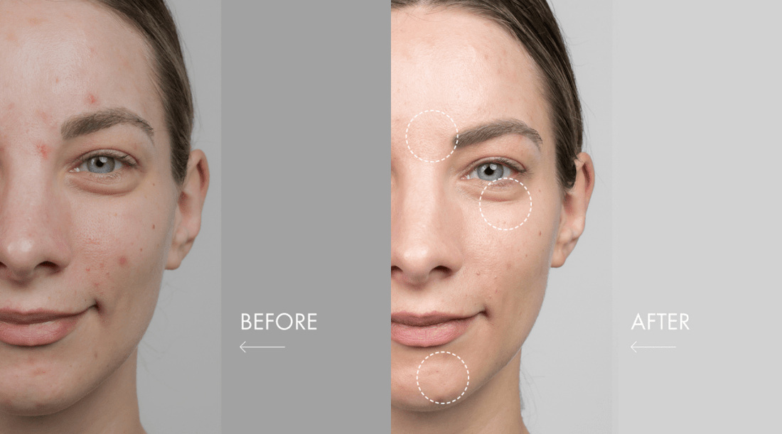 Vorher-Nachher-Effekte mit QMS Medicosmetics - QMS Medicosmetics GmbH