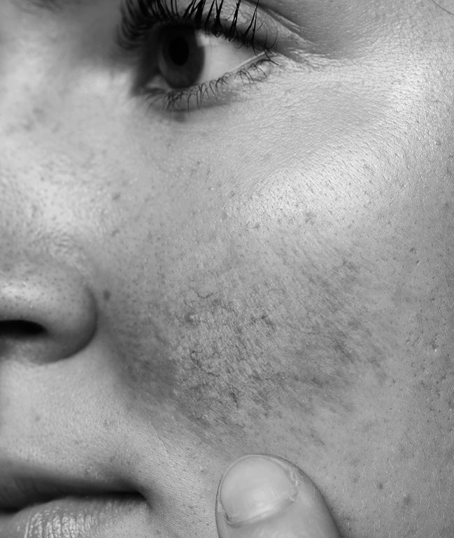 Sensible Haut - QMS Medicosmetics GmbH